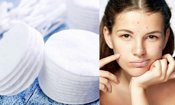 Tại sao tẩy trang kỹ nhưng vẫn bị mụn?